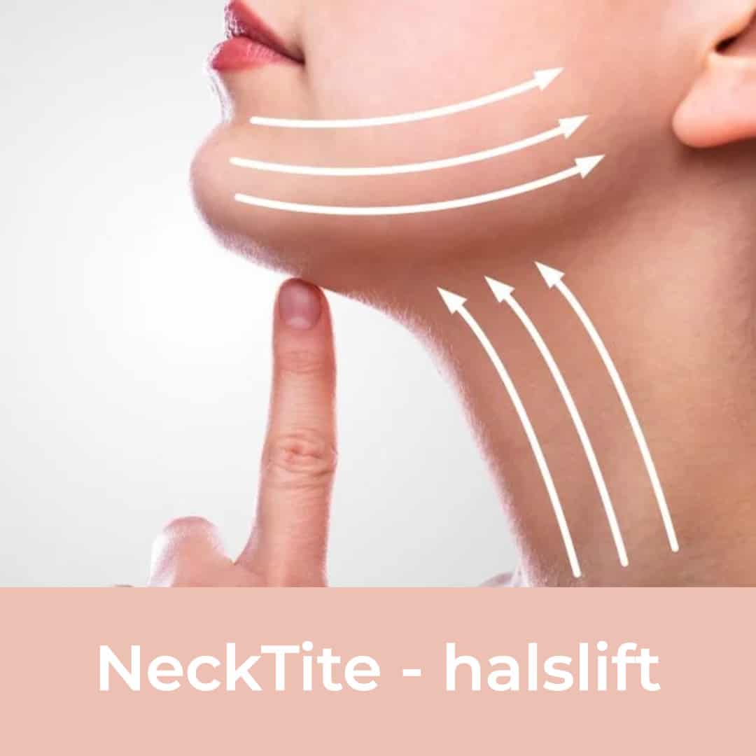 passie Bedenk Aanbeveling Halslift zonder operatie - NeckTite expertisecentrum - ReSculpt Clinic